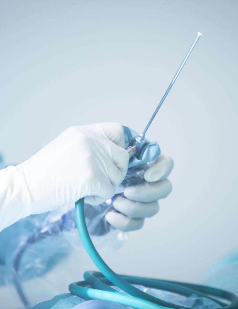 Endoscopy Devices Market in Africa 2024-2028