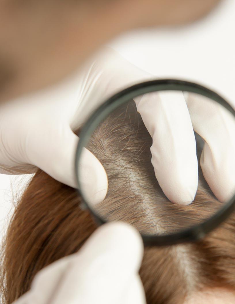 Global Lice Treatment Market 2024-2028
