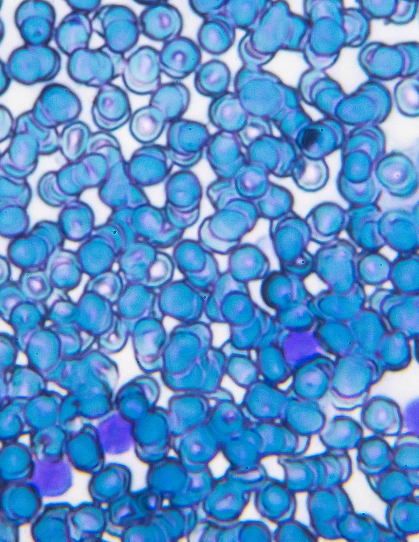 Global BCL-2 (B-cell lymphoma 2) inhibitors market 2024-2028