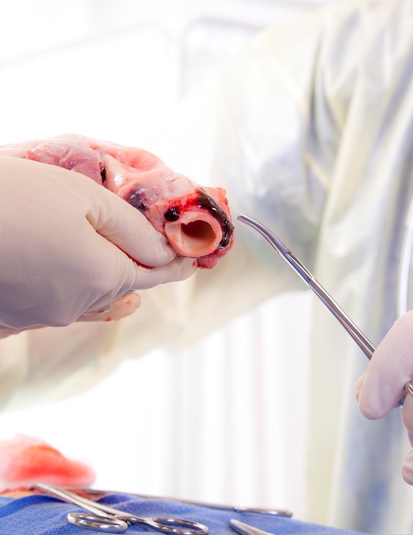 Global Heart Valve Repair And Replacement Devices Market 2025-2029