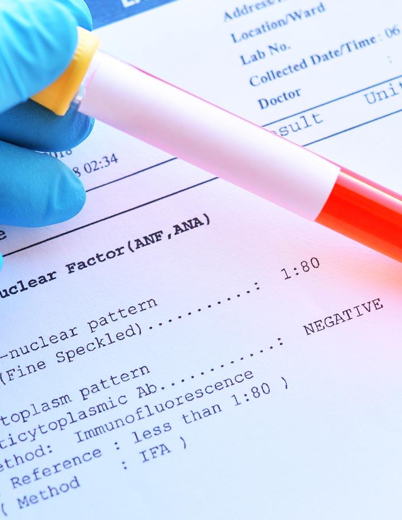 Global Antinuclear Antibody Test Market 2025-2029