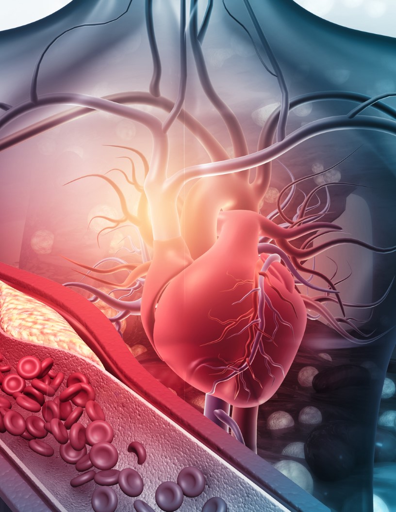 Global atherosclerosis therapeutics market 2024-2028