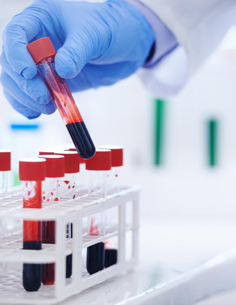 Global Blood Collection Tubes Market 2024-2028