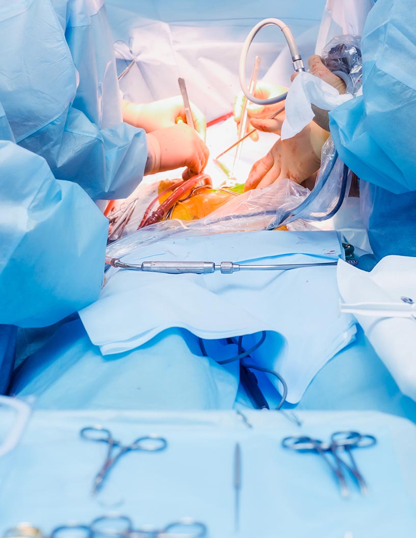 Global laparoscopic ablation market 2024-2028