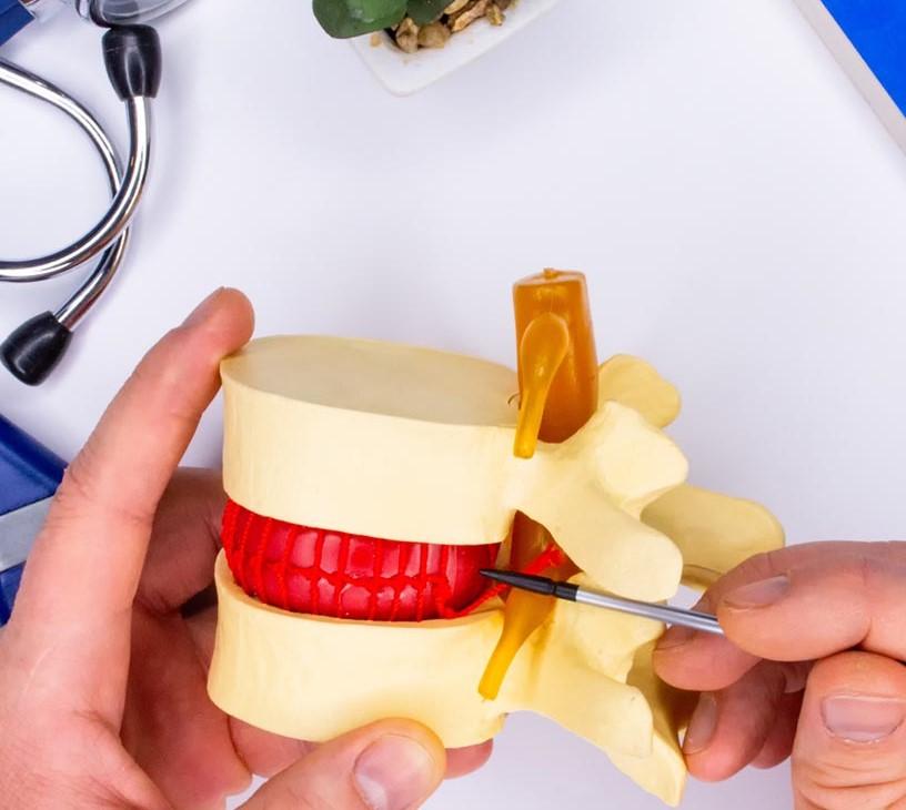 Global Sciatica Treatment Market 2025-2029
