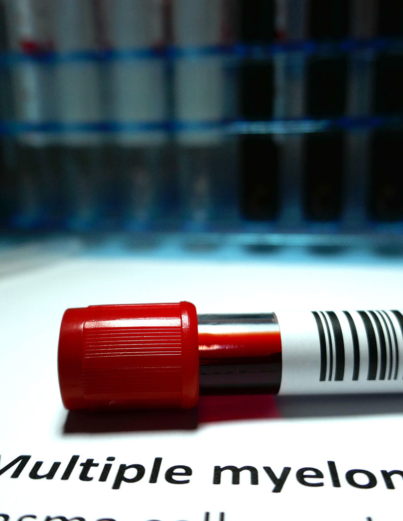 Global multiple myeloma drugs market 2024-2028