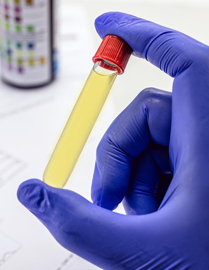 Global Toxicology Testing Market 2025-2029