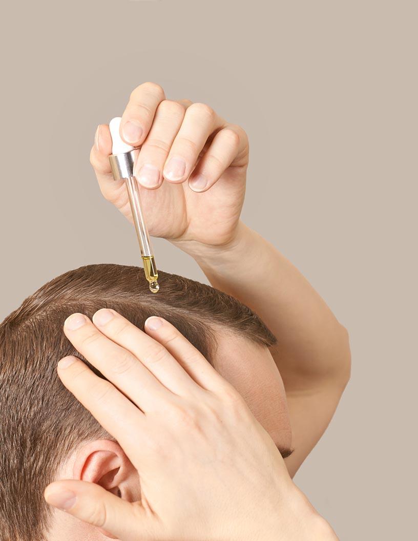 Global hair loss treatment products market 2024-2028