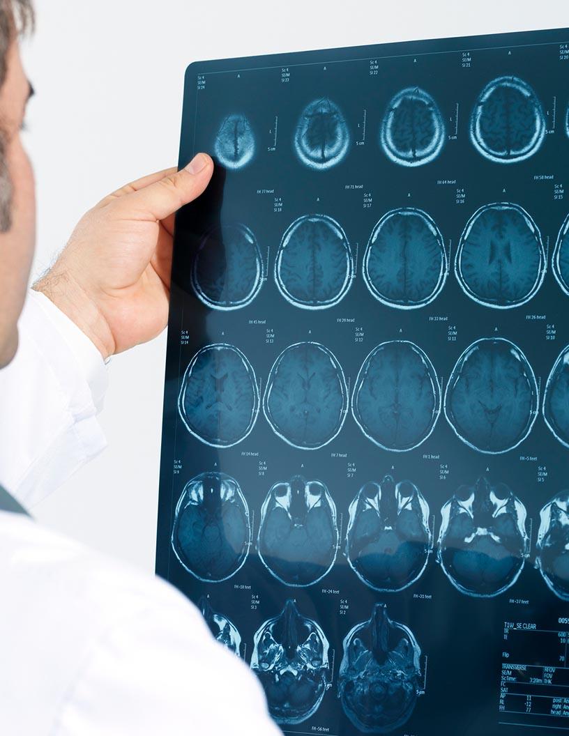 Global computed tomography (CT) market 2024-2028