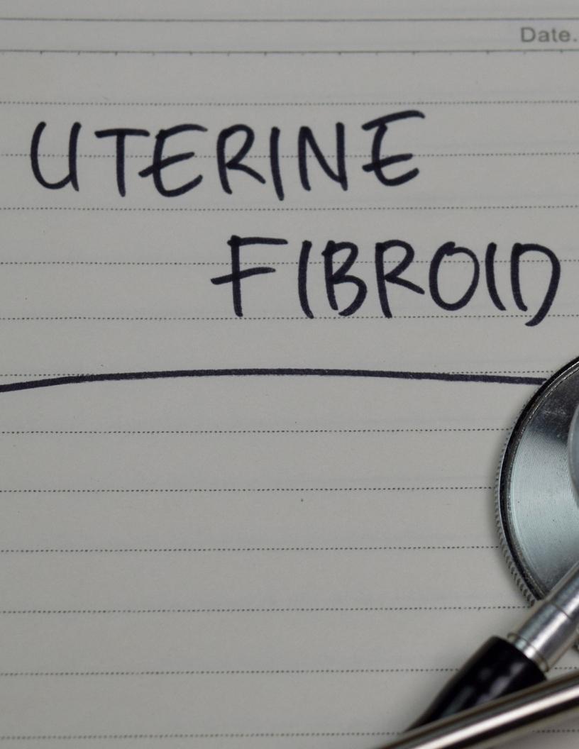 Global Uterine Fibroid (UF) Treatment Device Market 2025-2029