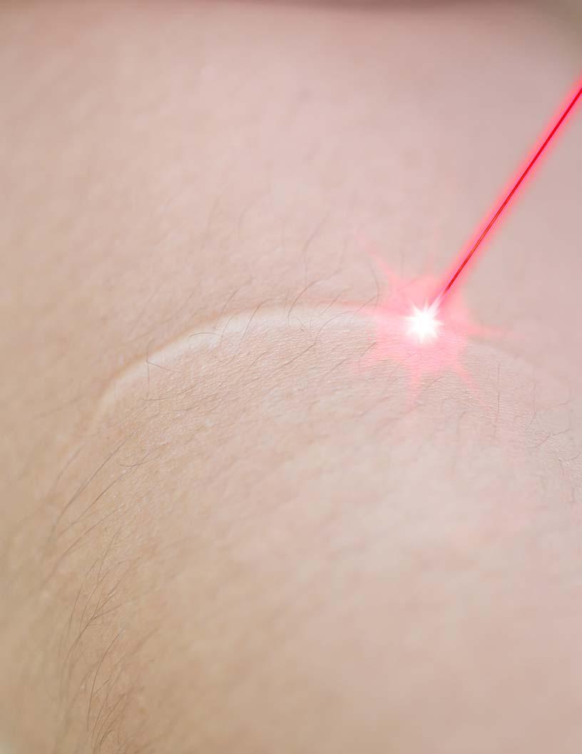 Global Scar Treatment Market 2025-2029