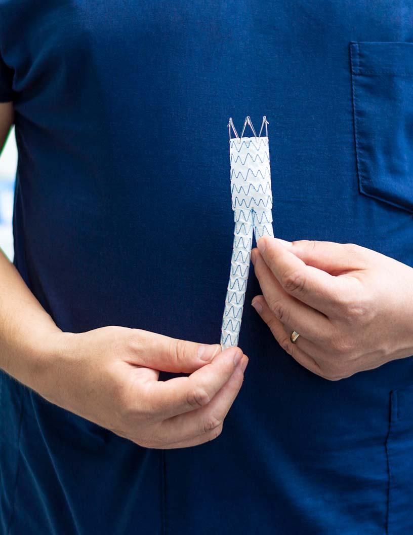 Global Endovascular Abdominal Aortic Aneurysm (AAA) Repair Devices Market 2025-2029