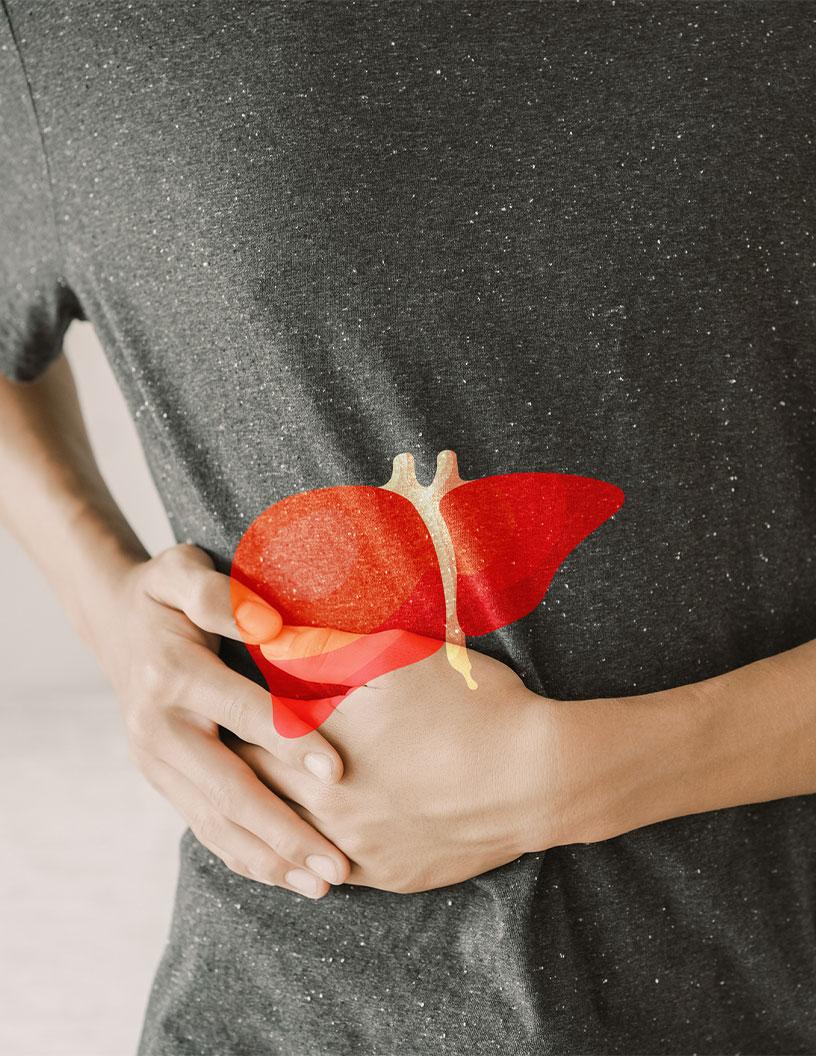 Global non-alcoholic steatohepatitis (NASH) market 2024-2028