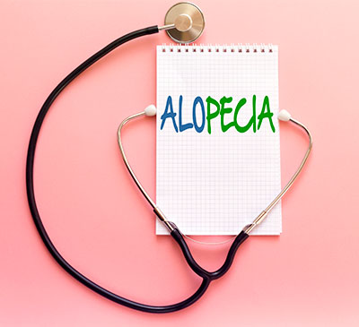 Alopecia Therapeutics - A Pipeline Analysis Report