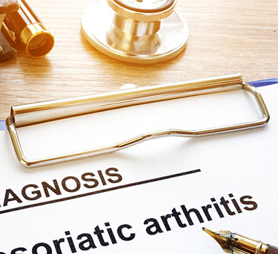 Global Psoriatic Arthritis Therapeutics Market 2019-2023