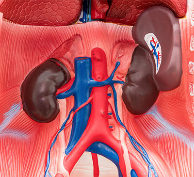 Ascites - A Pipeline Analysis Report
