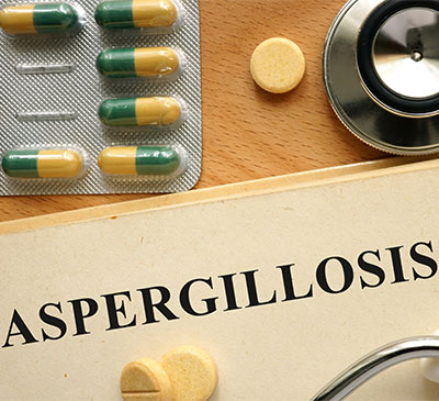 Aspergillosis - A Pipeline Analysis Report
