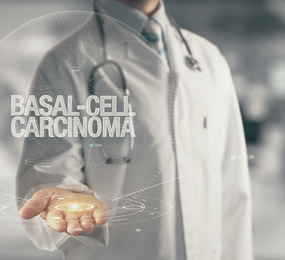 Basal Cell Carcinoma - A Pipeline Analysis Report