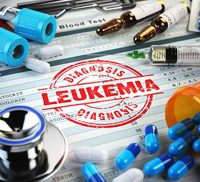 CAR T-cell therapy in Lymphocytic Leukemia - A Pipeline Analysis Report