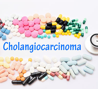 Global Cholangiocarcinoma Therapeutics Market 2019-2023