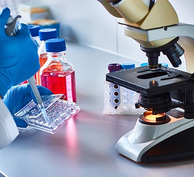 Chondrosarcoma - A Pipeline Analysis Report