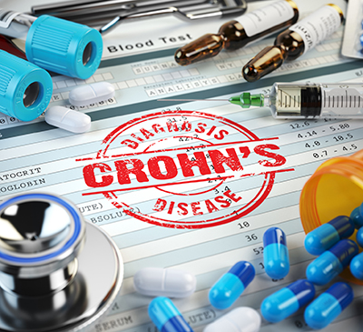 Crohn's Disease - A Pipeline Analysis Report