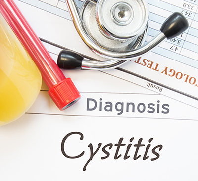 Cystitis - A Pipeline Analysis Report