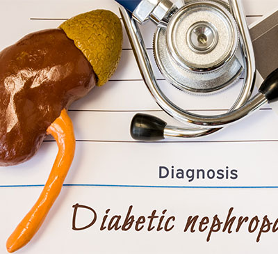 Diabetic Nephropathy - A Pipeline Analysis Report