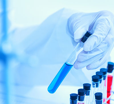 Global Dimethylformamide Market 2019-2023