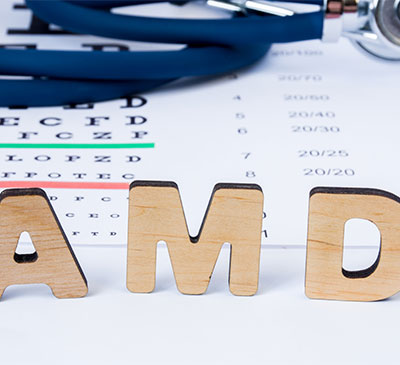 Dry Age-related Macular Degeneration - A Pipeline Analysis Report