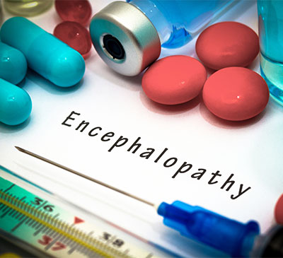 Encephalopathy - A Pipeline Analysis Report