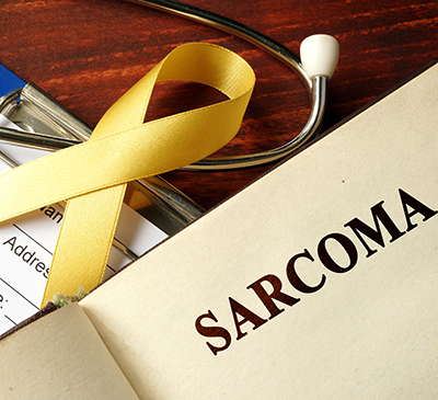 Ewing's Sarcoma - A Pipeline Analysis Report