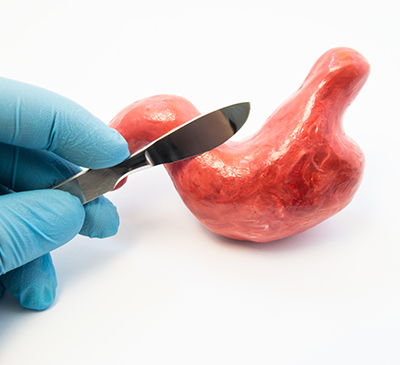 Gastroparesis - A Pipeline Analysis Report