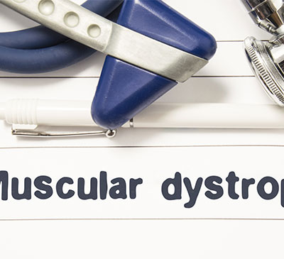 Gene Therapy for Muscular Dystrophy - A Pipeline Analysis Report