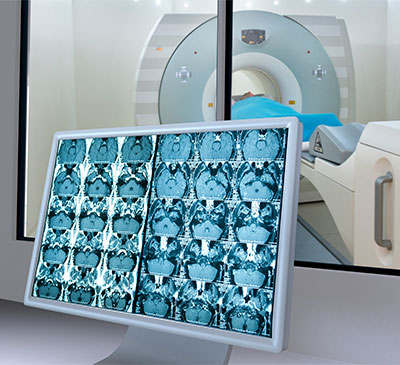 Global Advanced MRI Visualization Systems Market 2018-2022