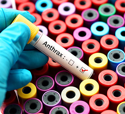 Global Anthrax Therapeutics Market 2019-2023