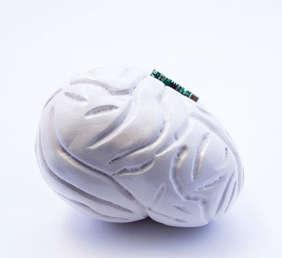 Global Brain Implants Market 2018-2022