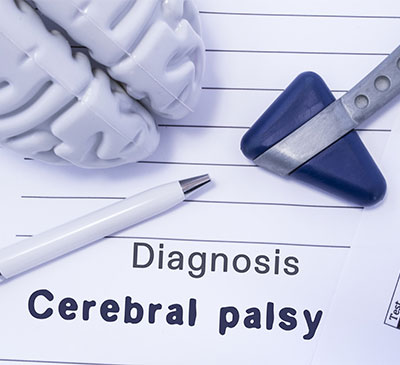 Global Cerebral Palsy Drugs Market 2019-2023