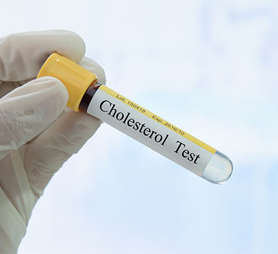 Global Cholesterol Testing Devices Market 2018-2022