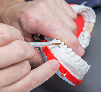 Global Cosmetic Implants Market 2019-2023