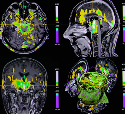 Electroencephalography Devices Market by Product and Geography - Forecast and Analysis 2021-2025