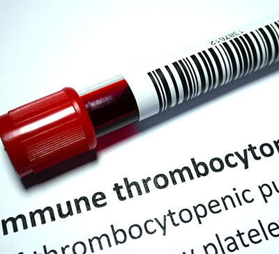 Global Idiopathic Thrombocytopenic Purpura Therapeutics Market 2019-2023