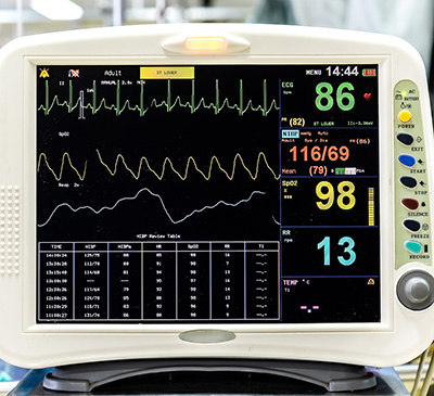 Global Nerve Monitoring Systems Market 2018-2022