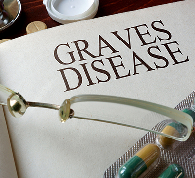 Graves' Disease - A Pipeline Analysis Report