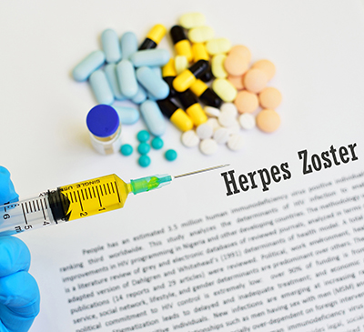 Herpes Zoster - A Pipeline Analysis Report