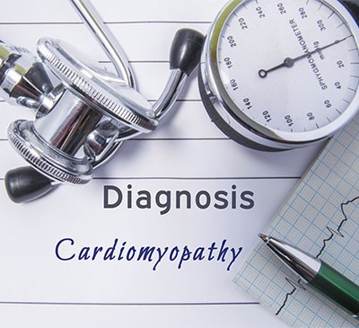 Hypertrophic Cardiomyopathy - A Pipeline Analysis Report