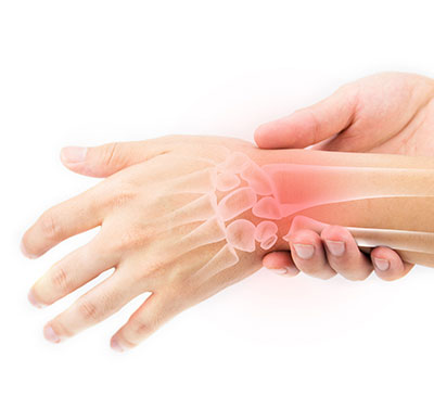 Hyperuricemia - A Pipeline Analysis Report