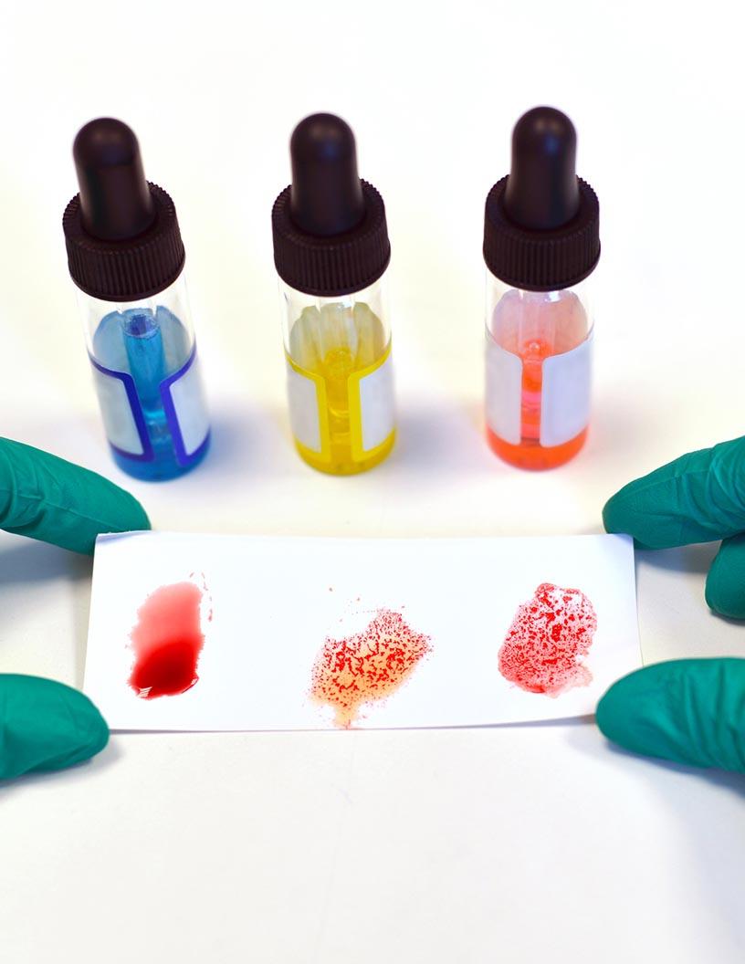 Blood-Grouping Reagents Market Analysis, Size, and Forecast 2025-2029: North America (US and Canada), Europe (France, Germany, Italy, and UK), APAC (China, India, Japan, and South Korea), and Rest of World (ROW)