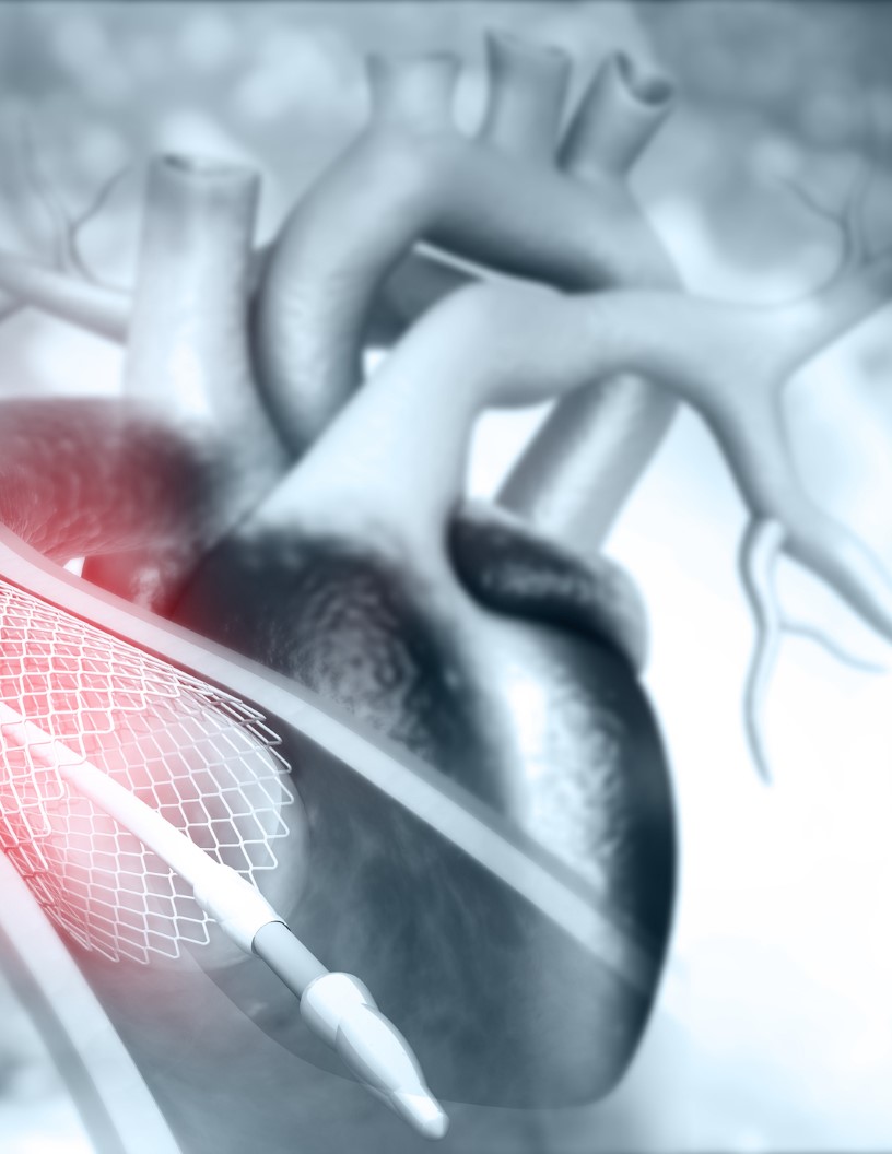 Vascular Embolization Devices Market Analysis North America, Europe, Asia, Rest of World (ROW) - US, Germany, France, UK, Japan - Size and Forecast 2024-2028