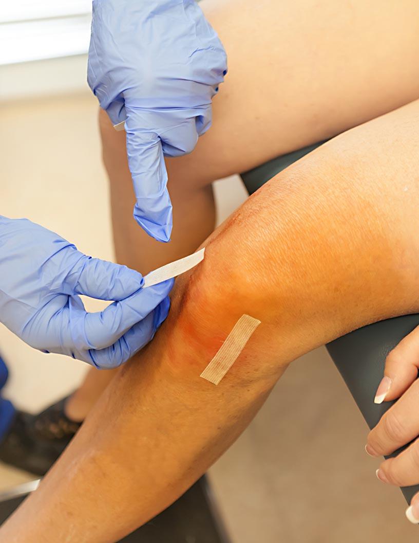 Wound Closure Strips Market Analysis North America, Europe, Asia, Rest of World (ROW) - US, Germany, China, India, Canada, UK, Japan, South Korea, France, Italy - Size and Forecast 2025-2029